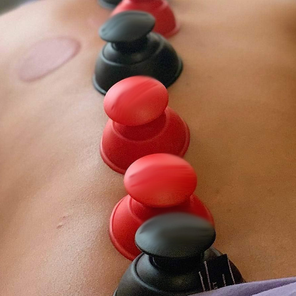 Portable Cupping Set (2-Piece with Carrying Case) — Traditional Chinese Therapy Home Massage Tool