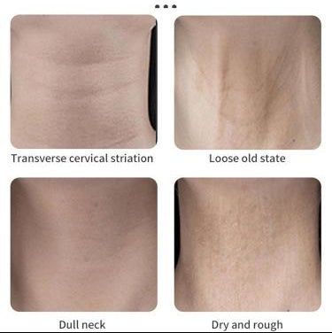 Invisible Neck Lift Tape — Instant Firming Neck Skin Beauty Strips