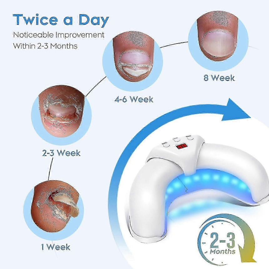 Foldable Nail Fungus Laser Treatment Device – Multi-Toenail & Fingernail Light Therapy with 18 LEDs