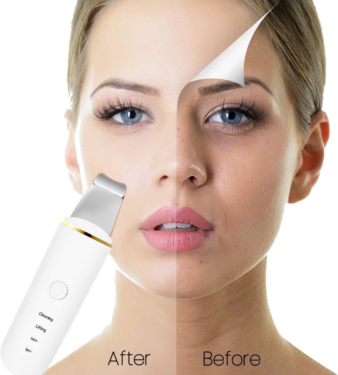 Multifunctional Skin Cleansing Massager - Removes Blackheads, Pimples