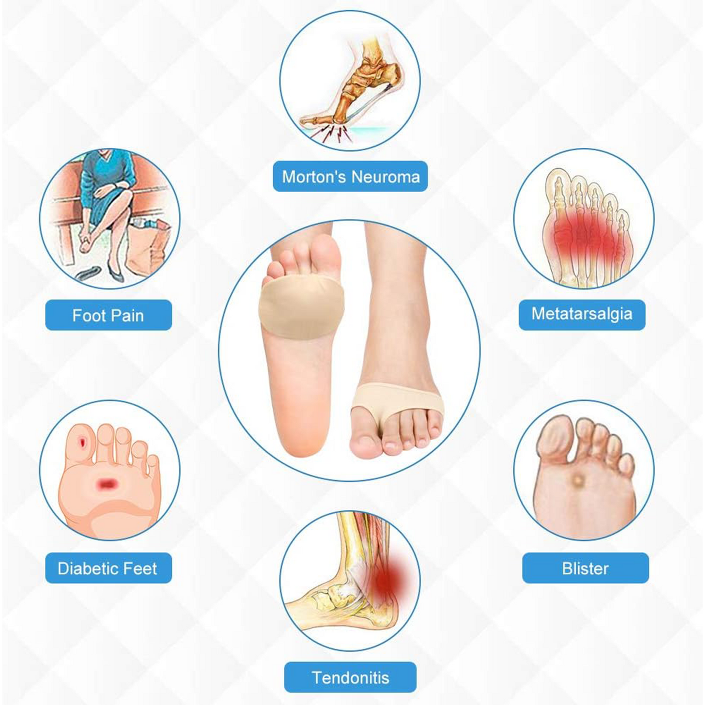 Arch support orthotics for plantar fasciitis