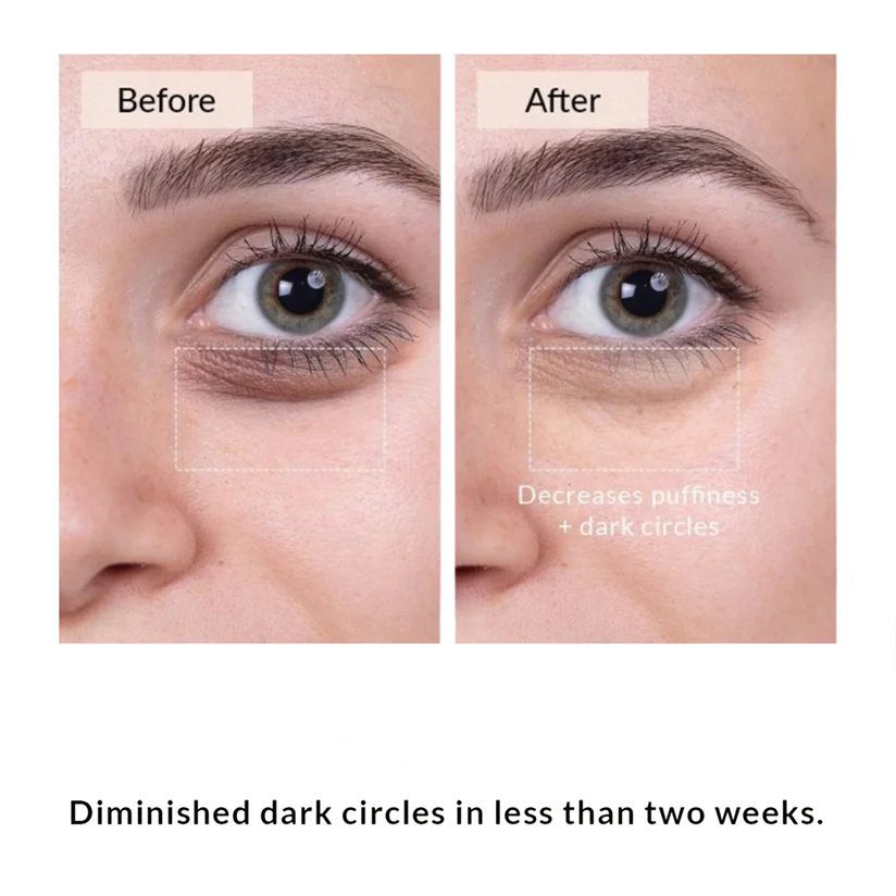 Micro Eye Toner - Improves fine lines and sagging around the eyes